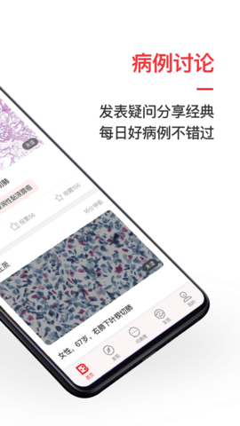 爱病理 v3.6.1 安卓版截图_4