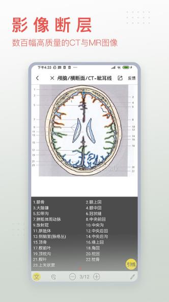 3Dbody解剖截图_3