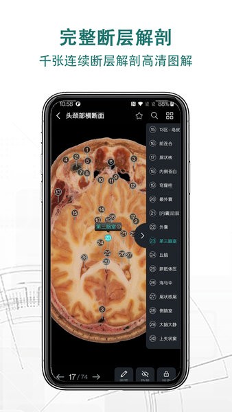 掌上3D解剖截图_1